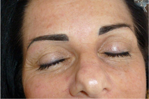   Pernanent Makeup Eyebrows After