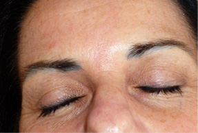  Pernanent Makeup Eyebrows Before