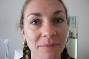   Permanent Eyeliner Makeup Before